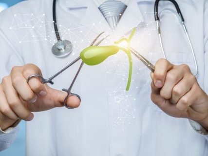 Дієта після видалення жовчного міхура | 5 практичних рекомендацій операції